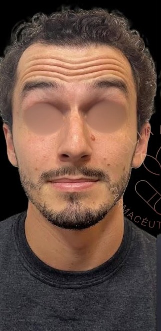 Antes
