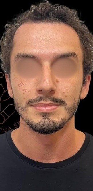 Depois